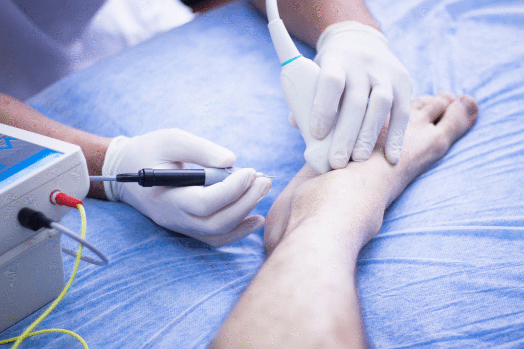 Perkütan Elektroliz Tedavisi